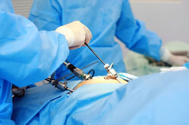 general-laparoscopic-surgery